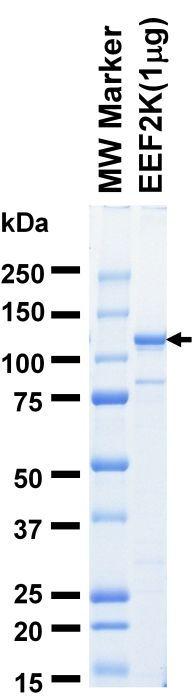 The purity was assessed by SDS-PAGE/CBB staining.